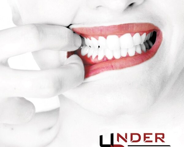 Recensione: Underdocks, “Burnt”