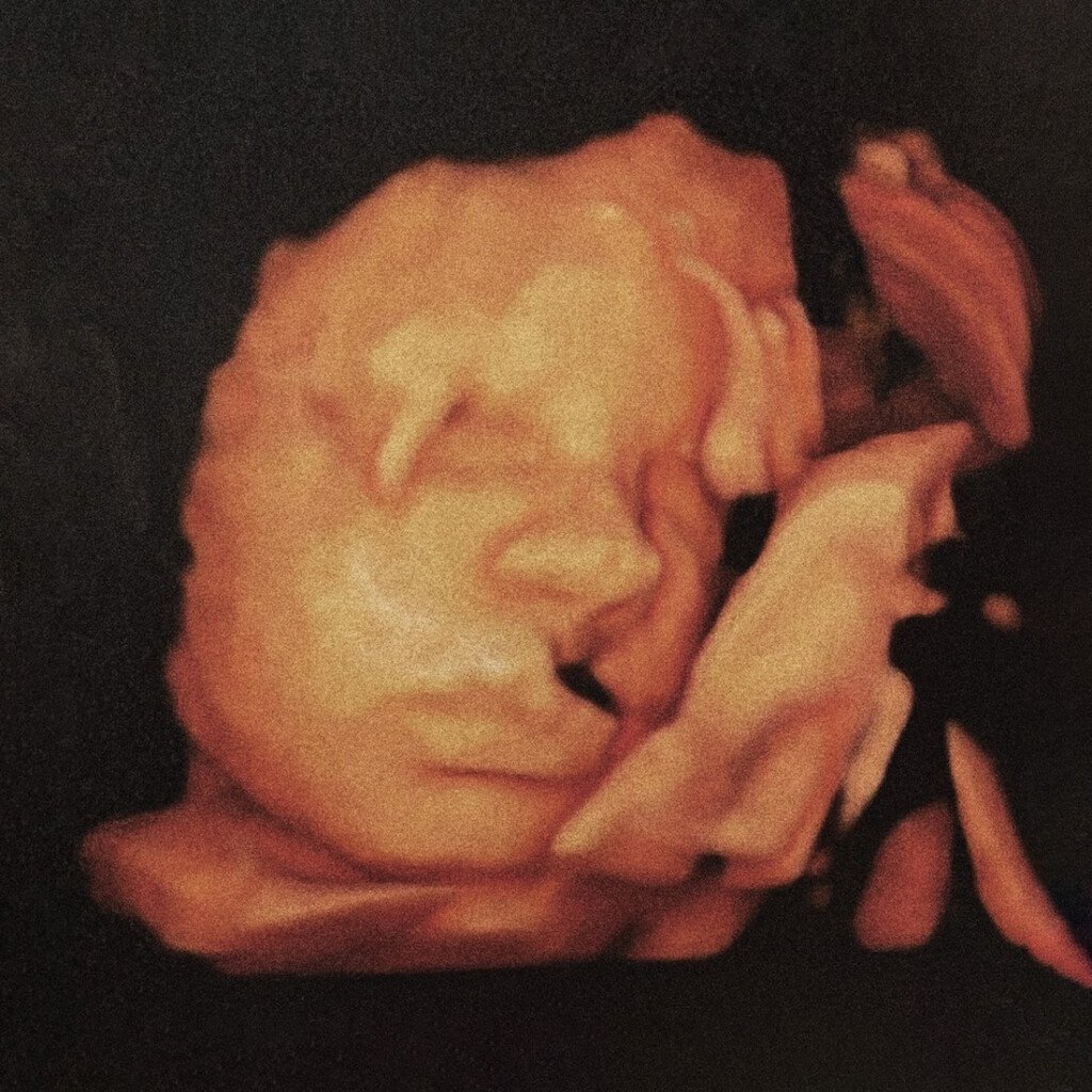 brucherò nei pascoli